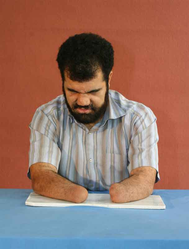 گزیده احکام رساله مصور جانبازان؛ احکام تیمم(1) تیمّم کسی که دستانش قطع شده گزیده احکام رساله مصور جانبازان؛ احکام تیمم(1) تیمّم کسی که دستانش قطع شده
