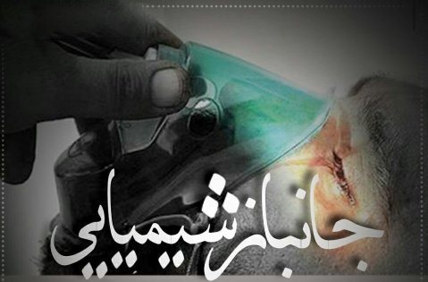 ویژهنامه جانبازان شیمیایی استان البرز ویژهنامه جانبازان شیمیایی استان البرز